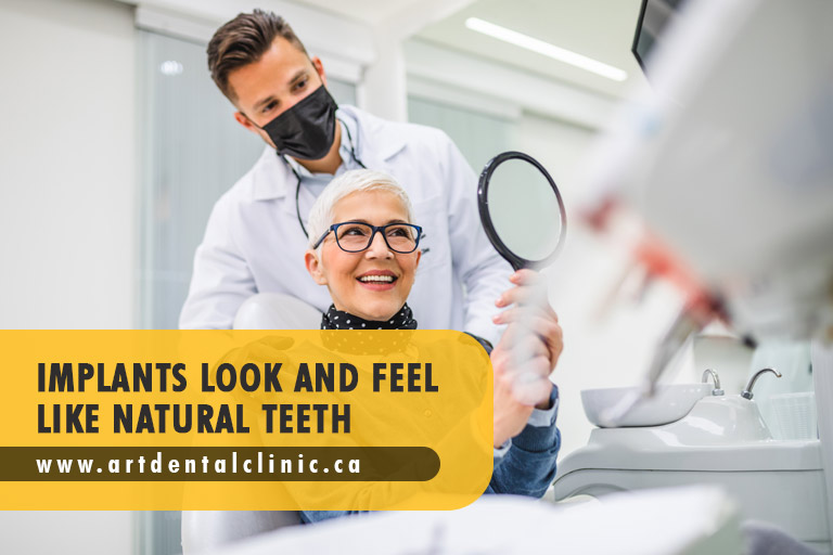 Implants look and feel like natural teeth