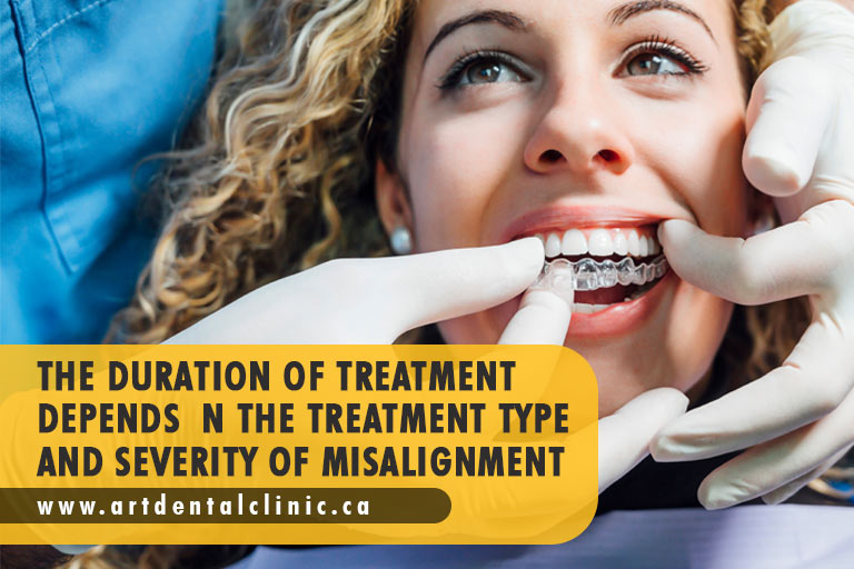 The duration of treatment depends on the treatment type and severity of misalignment
