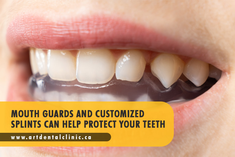 Mouth guards and customized splints can help protect your teeth