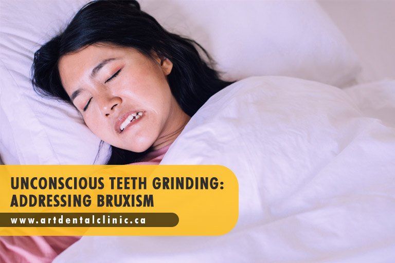 Unconscious Teeth Grinding: Addressing Bruxism